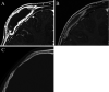 FIG. 4.