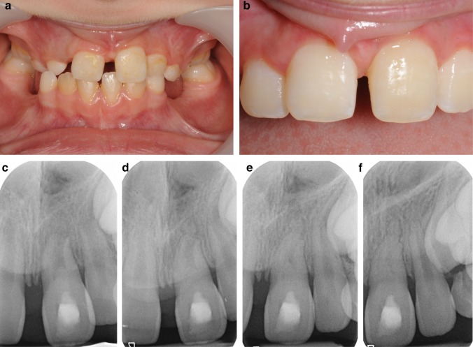 Fig. 3