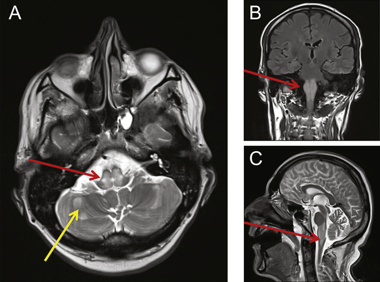 Fig.1