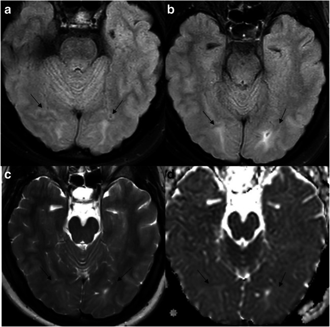 Fig. 5