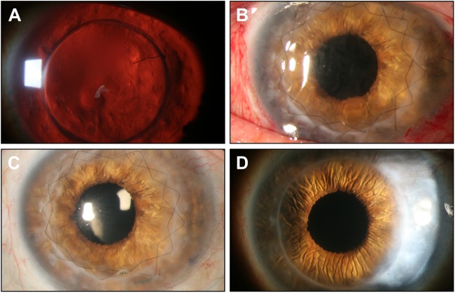 Fig. 3