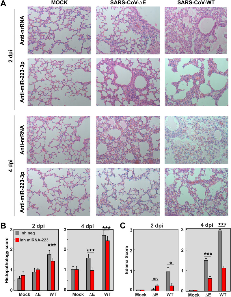 FIG 4