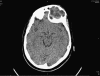 Fig. 1