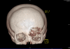 Fig. 3