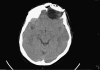 Fig. 4