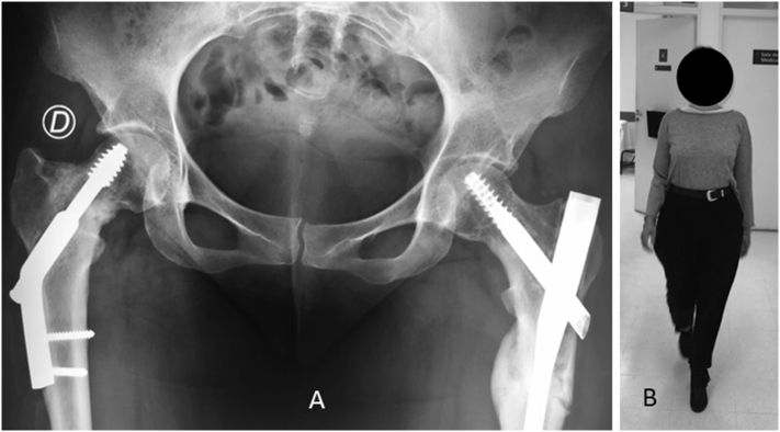 Fig. 8