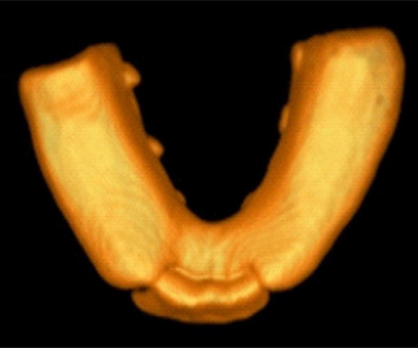 Figure 15.