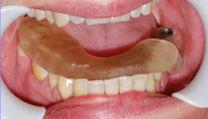 Figure 13.