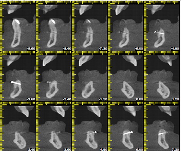 Figure 14.