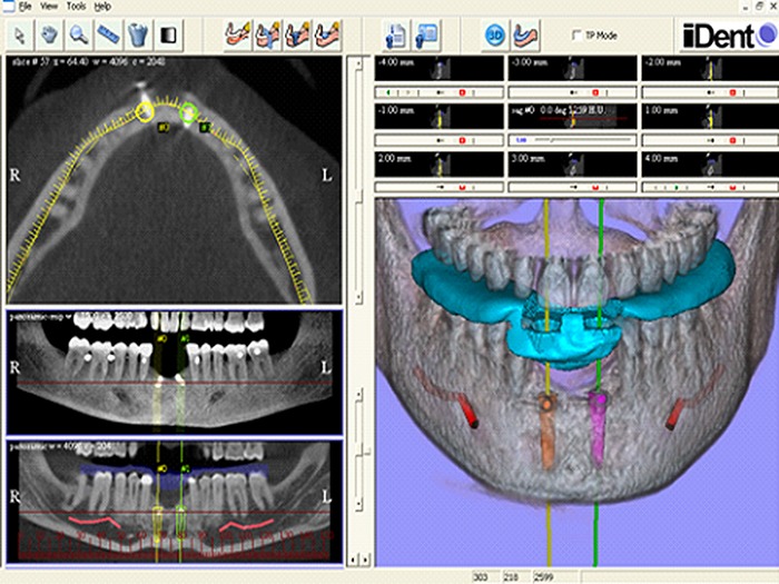 Figure 16.