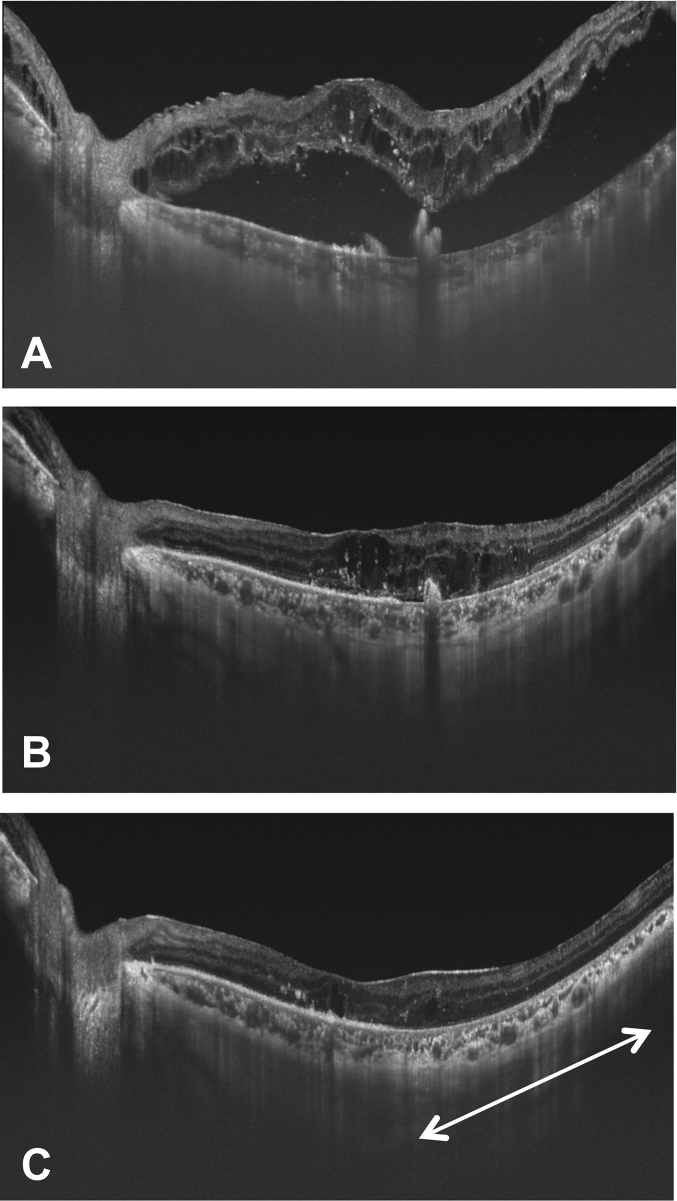 Fig. 2