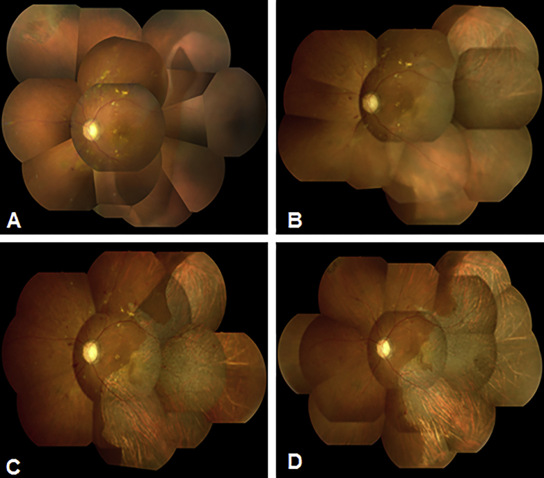 Fig. 1