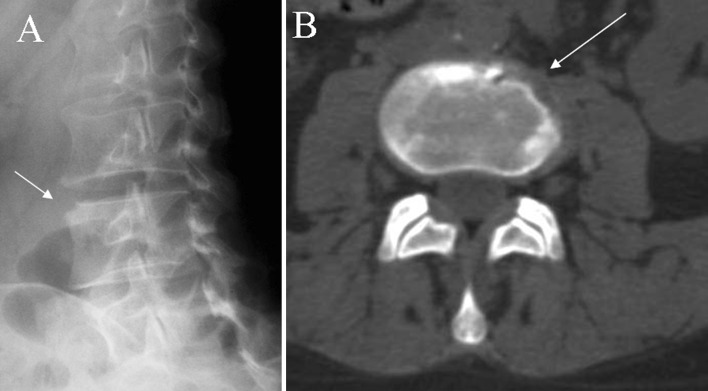 Fig. 1