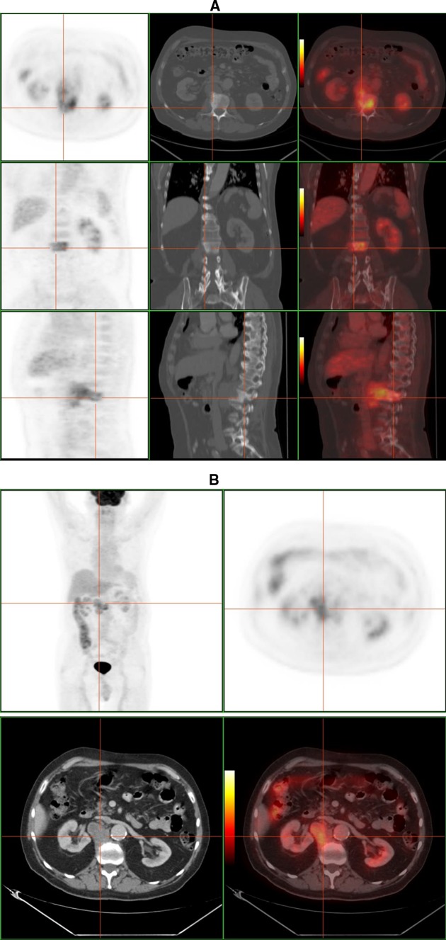 Fig. 10