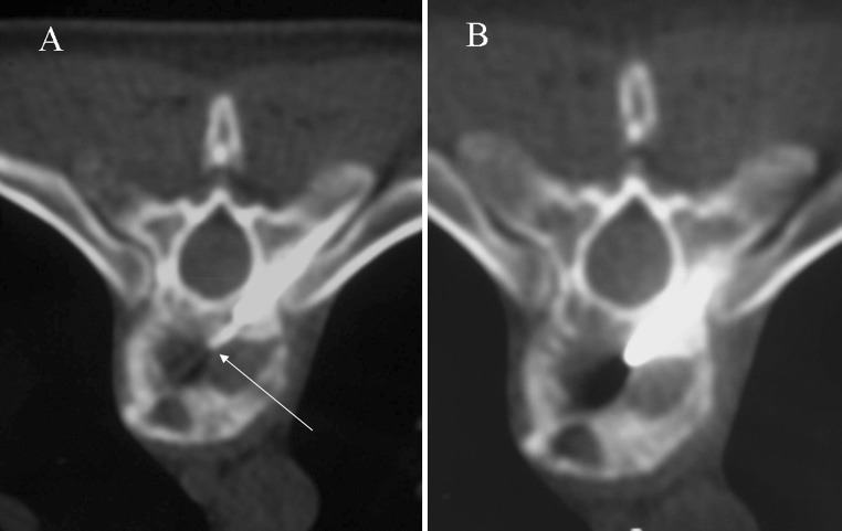 Fig. 11