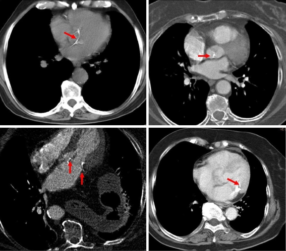 Fig. 2