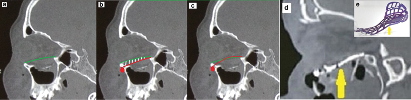 Fig. 5