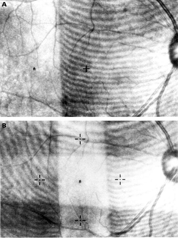 Figure 1  