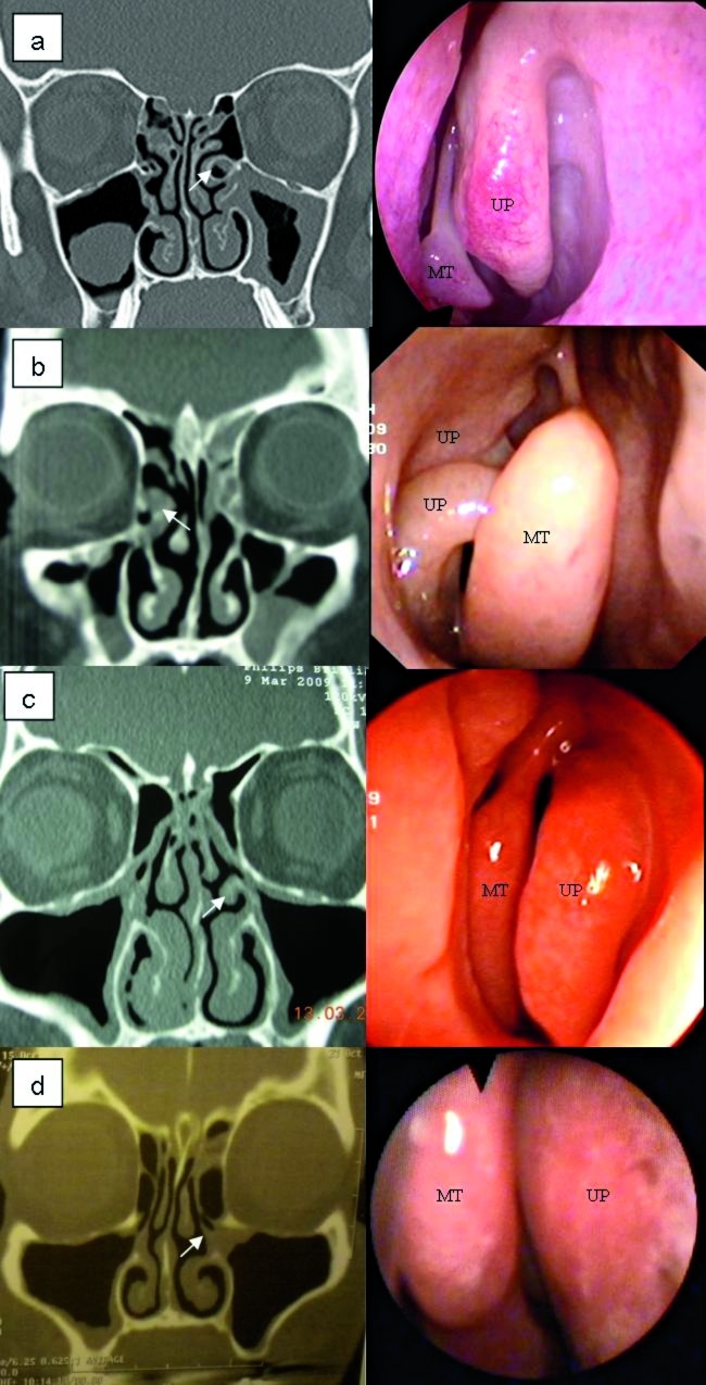 Fig. 5.