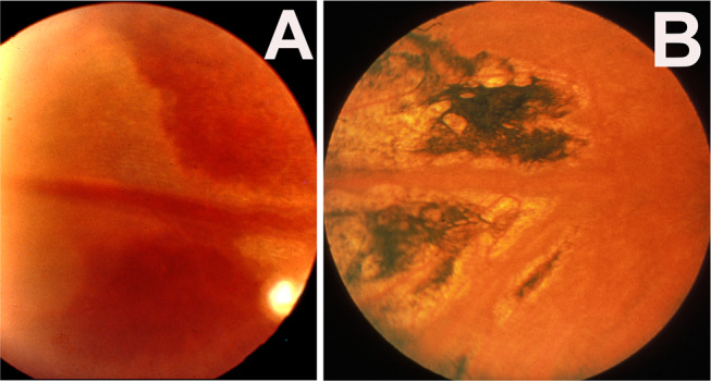 Fig. 12