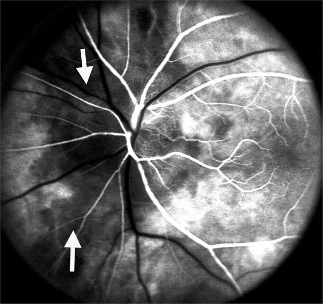 Fig. 5