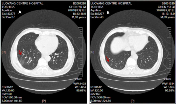 Fig. 3