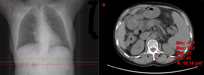 Fig. 1