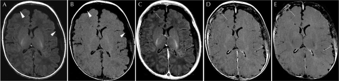 Fig 2.