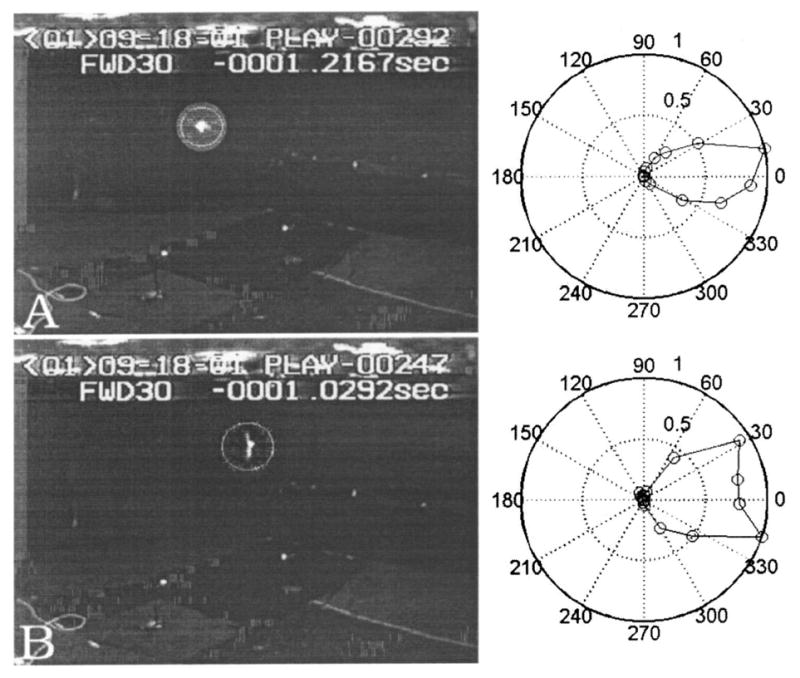 FIG. 11