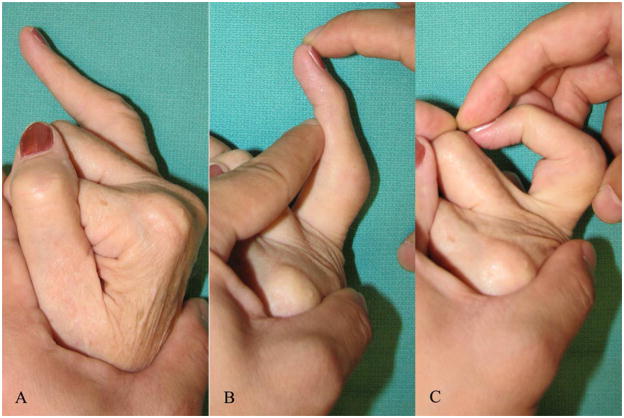 Figure 10