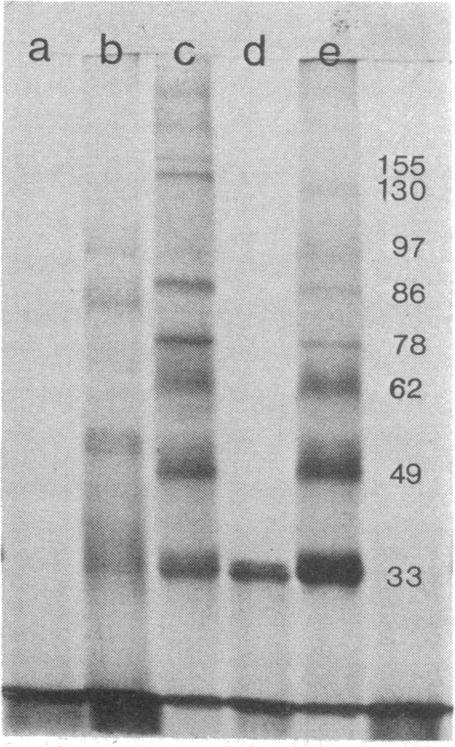 graphic file with name pnas00039-0122-a.jpg