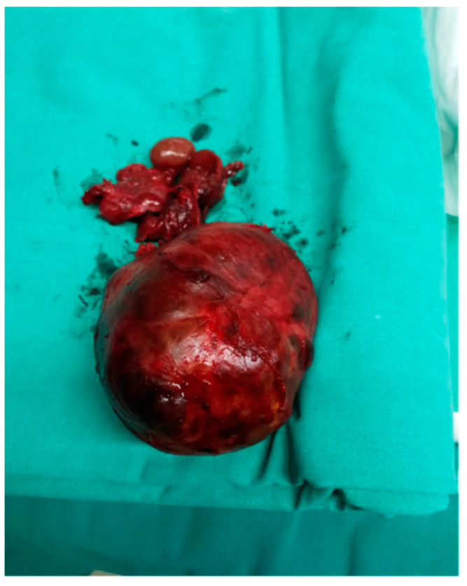 Figure 6