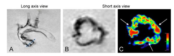 Fig. 2