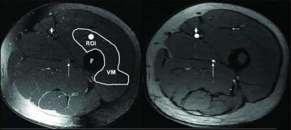 Figure1