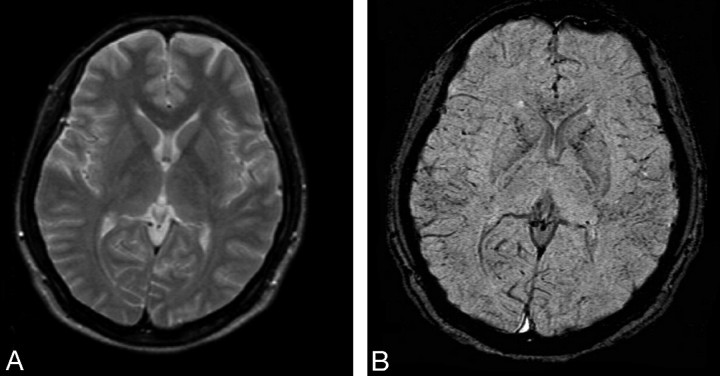 Fig 2.