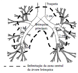 Figura 2