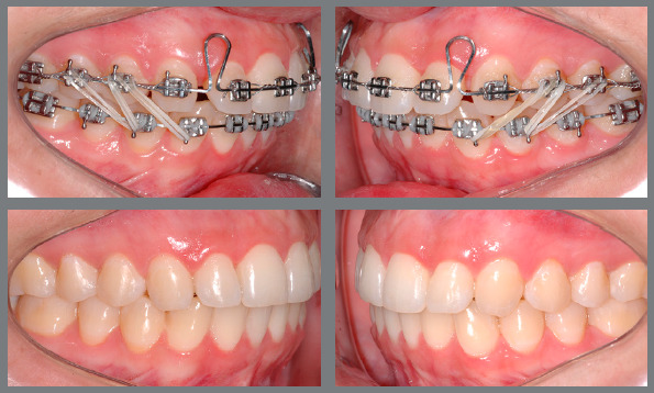 Figure 23: