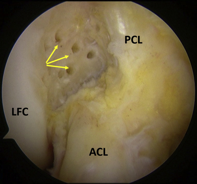 Fig 4