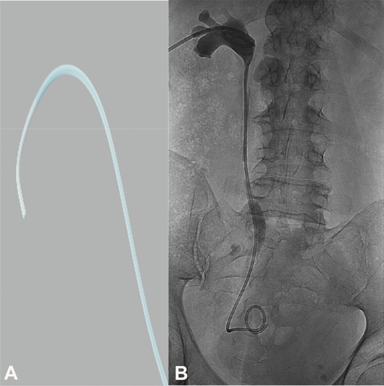 Evaluation of Galdakao-modified Valdivia position in endoscopic ...