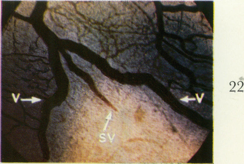 Fig. 22