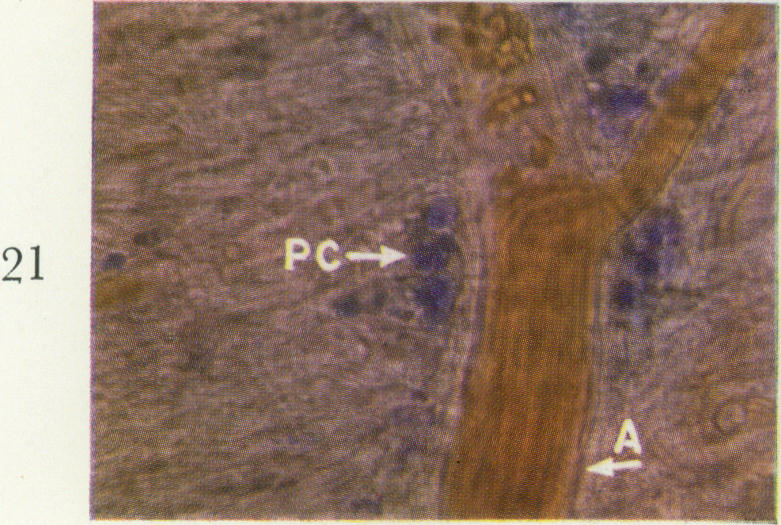 Fig. 21