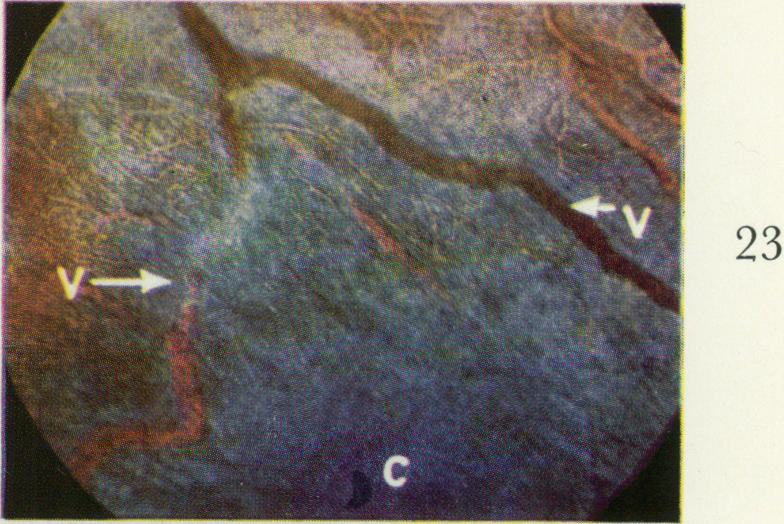 Fig. 23