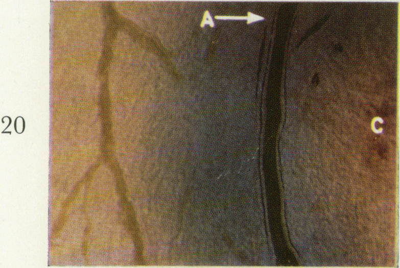 Fig. 20