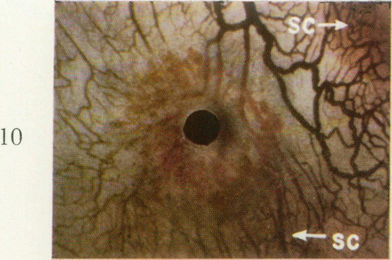 Fig. 10