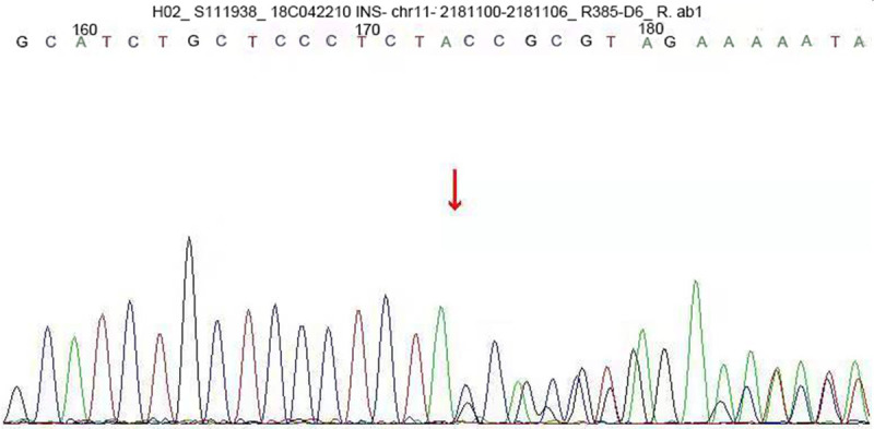 Figure 2