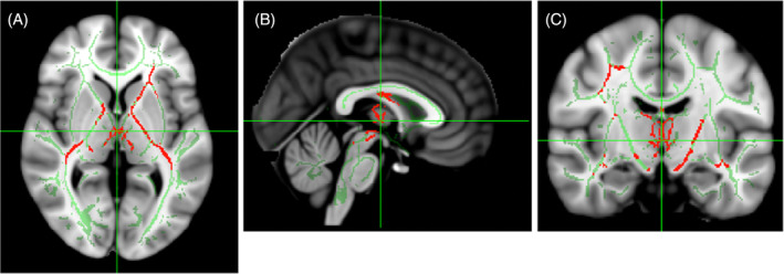 FIGURE 2