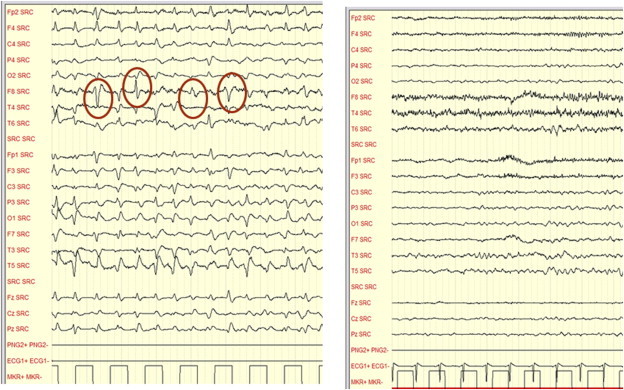 Figure 2