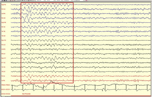 Figure 3