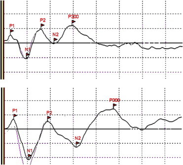 Figure 4