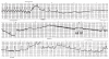 Figure 1)
